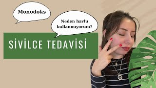 Sivilce Tedavim -  Monodoks Kullanmak - Neden Roaccutane Değil?