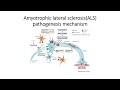 Motor neuron disorder: Voluntary Muscle paralysis or Amyotrophic lateral sclerosis (ALS) #Code: 188