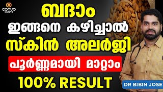 ബദാം ഇങ്ങനെ കഴിച്ചാൽ സ്കിൻ അലർജി പൂർണ്ണമായി മാറ്റാം | Allergy Treatment at Home| Dr Bibin Jose