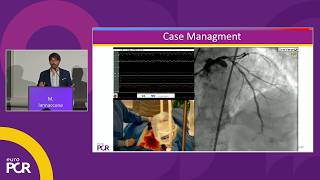 Navigating high-thrombus burden in ACS: precision aspiration thrombectomy with CAT RX - EuroPCR 2026