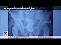 കരിപ്പൂരിൽ വീണ്ടും സ്വർണ്ണവേട്ട പിടികൂടിയത് ഒന്നരക്കോടിയുടെ സ്വർണ്ണം karipur airport