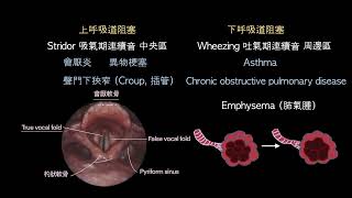 胸腔內科1 胸部理學檢查/氣血胸