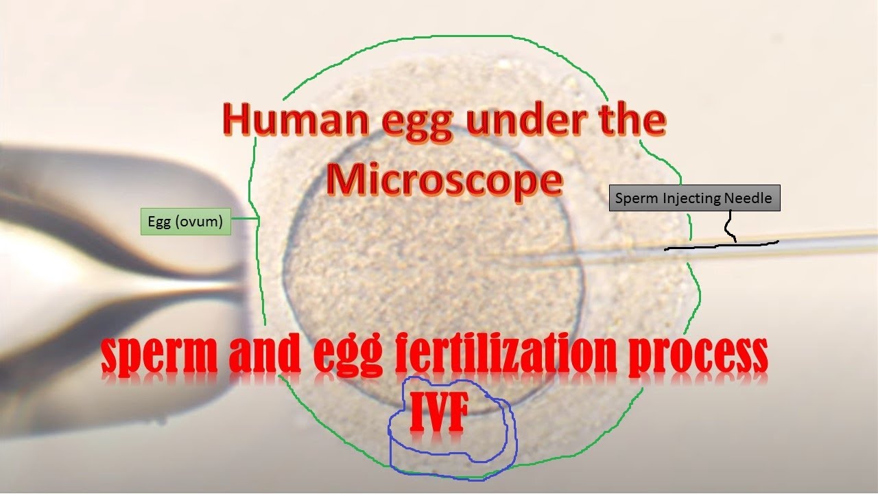 Human Eggs Under The Microscope During Ivf Fertilization Youtube