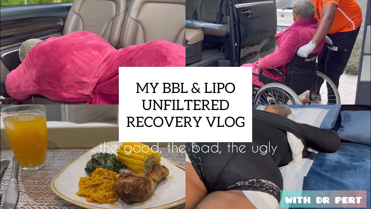 MY REVENGE BODY | Part 2 (Post - Op) RAW & UNFILTERED BBL RECOVERY VLOG ...