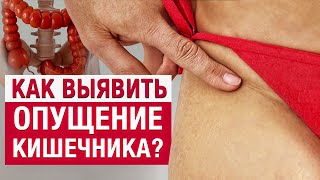 БЕГИТЕ к врачу, если заметили ЭТИ признаки! / Опущение внутренних органов — первые симптомы