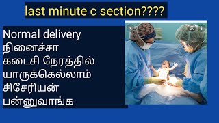 last minute c section/ கடைசி நேரத்தில் யாருக்கெல்லாம் சிசேரியன் பன்னுவாங்க