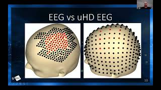 How to record EEG with 1024 channels with g.PANGOLIN ultra high-density EEG system