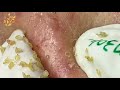 satisfying relaxing best video with hana beauty 06