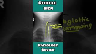 Steeple sign in CROUP explained in USMLE, NEET PG,, INICET, NCLEX