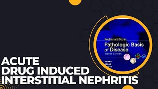 Acute drug induced interstitial nephritis | Causes| Pathogenesis | Morphology | Clinical features