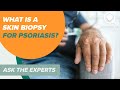 Symptoms and Causes for Psoriasis | Ask The Experts | Sharecare