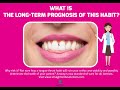 What is a Tongue Thrust? https://www.straightsmilesolutions.com/