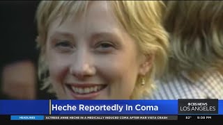 Actress Anne Heche in critical condition, her manager says