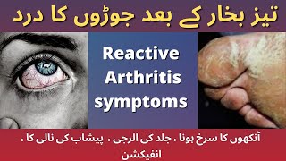 Reactive Arthritis (part#2) symptoms- causes-Diagnosis-Tests and Treatment  || Reiter’s Syndrome