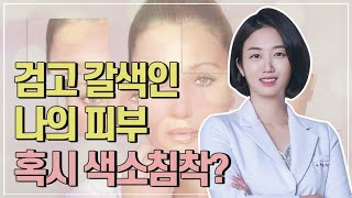 검고 갈색인 나의 피부... 혹시 색소침착? 원인과 예방법!