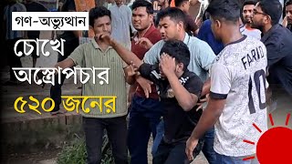 ছাত্র-জনতার আন্দোলন: ছররা গুলিতে চোখ নষ্ট ৪০১ জনের | Quota Movement 2024 | Prothom Alo