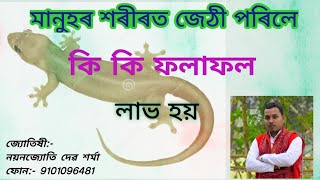 মানুহৰ শৰীৰত জেঠী পৰাৰ ফলাফল\nAstrologer Nayan jyoti sarma