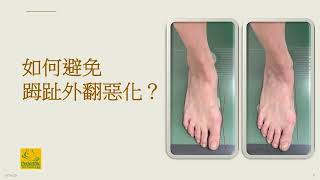 【𧿹趾外翻講座】腳趾不好全身歪?