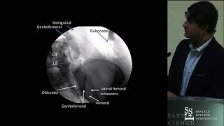 Difficult Lateral Cases (2018) - Rod Oskouian, MD