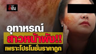 อุทาหรณ์ สาวหน้าพัง เพราะโปรโมชั่นราคาถูก | อีจัน EJAN