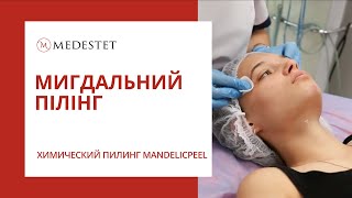 Летний химический миндальный пилинг MANDELICPEEL 40% в Косметологии Медэстет Винница