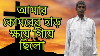 আমার কোমরের হাড় ক্ষয়ে গিয়ে ছিল