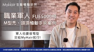 【M型禿+頭頂落髮】職業軍人也要很有型，FUE微創隱痕 - 植髮5000根 | MyHair生髮植鬍