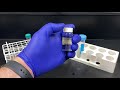 extraction of dna from e coli