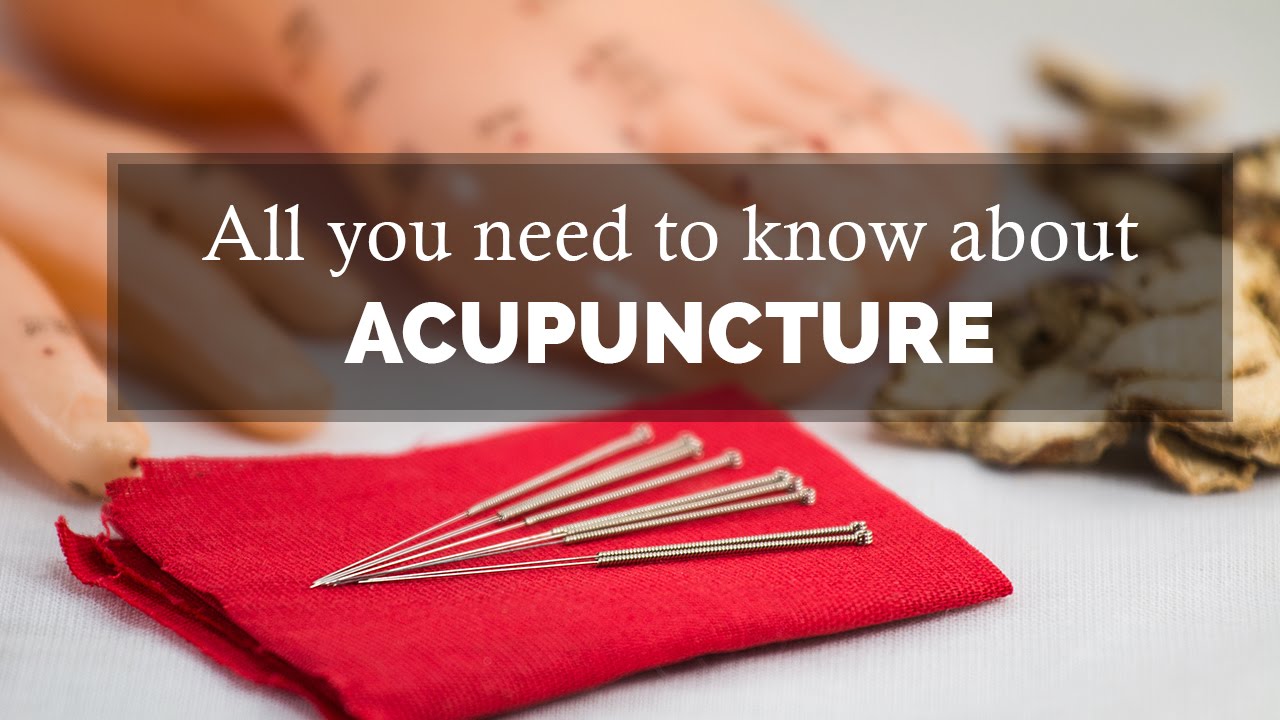 Acupuncture Treatment - All You Need To Know | Therapy - YouTube