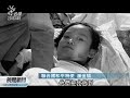 20111108 公視晚間新聞 小女孩遭燒傷 回顧殘酷越戰故事