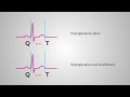 should qt prolonging drugs be prescribed to type 1 diabetic patients