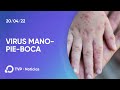 Alerta por el regreso del virus Mano-pie-boca