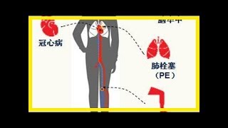 再這樣洗碗，細菌就全吃進肚子裡，會讓全家人生病！趕快改！別說沒告訴你！