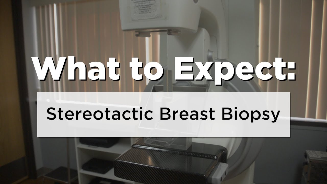 What To Expect: Stereotactic Breast Biopsy - YouTube