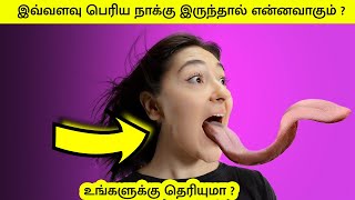 இவ்வளவு பெரிய நாக்கு இருந்தால் என்னவாகும்? | Tongue Overgrowth #Shorts #motivation