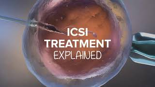 ICSI EXPLAINED