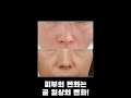 50대피부를 20대로 기미 모공 탄력 한번에 해결하는 코스멜란 동안전문가 기미전문가🚫공동구매는 26일부터🚫