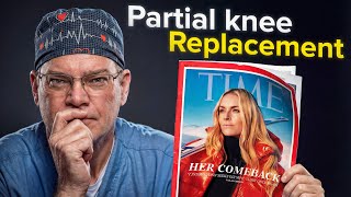 Partial Knee Replacements | Partially Successful?