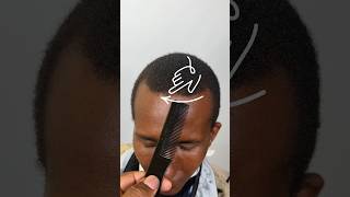 $100 Receding HAIRLINE Fix ‼️😫💈