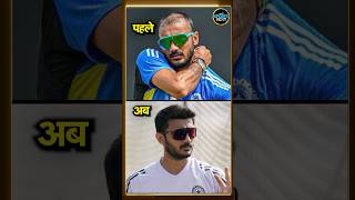 Axar Patel Hair Transplant: अक्षर पटेल का बदला लुक, बापू ने कराया ट्रांसप्लांट | #shorts