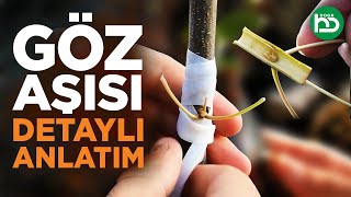 Göz Aşısı Nasıl ve Ne Zaman Yapılır, Göz Aşısı Çeşitleri (gözaşısı/1)