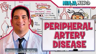 Peripheral Artery Disease | Retired