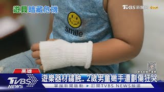 心疼! 2歲童玩溜滑梯慘遭割傷 廟方:全面封閉維修｜TVBS新聞 @TVBSNEWS02