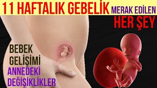 11 Haftalık Gebelik (2025)