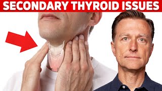 Most Thyroid Issues Are Secondary to Other Problems – Dr. Berg