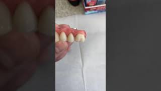 Diferença entre Dentadura x Dentadura Fixa, implante dentário.