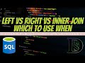 Anthony Explains the Choice Between Left vs Right vs Inner Join - SQL Server Help - ReadySetData