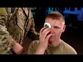 rigid eye shield application