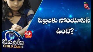 పిల్లలకు సోరియాసిస్ ఉంటే? | జీవనరేఖ చైల్ద్ కేర్ | 22nd సెప్టెంబర్ 2021| ఈటీవీ  లైఫ్