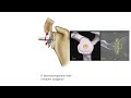 total shoulder replacement surgical technique